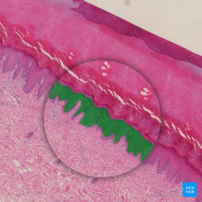 Estrato espinoso (Stratum spinosum epidermis); Imagen: 