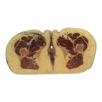 Female pelvis