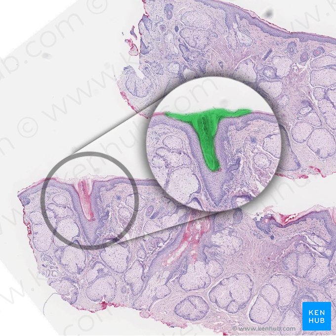 Excretory pore (Porus sudorifer); Image: 