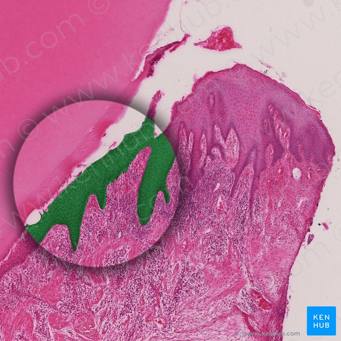 Sulcular epithelium; Image: 