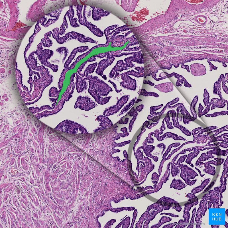 Lymphatic vessel - histological slide