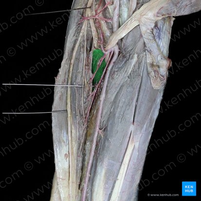 Muscle supinateur (Musculus supinator); Image : 