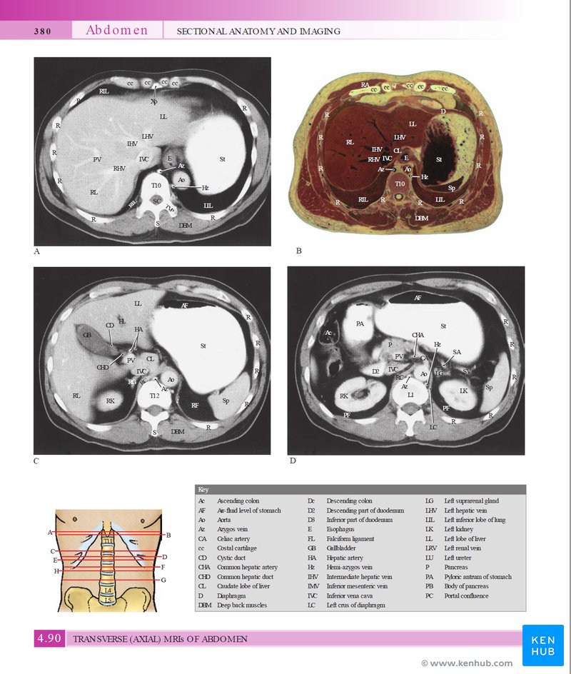 Grant's Atlas of Anatomy - Cadaveric and radiological illustrations