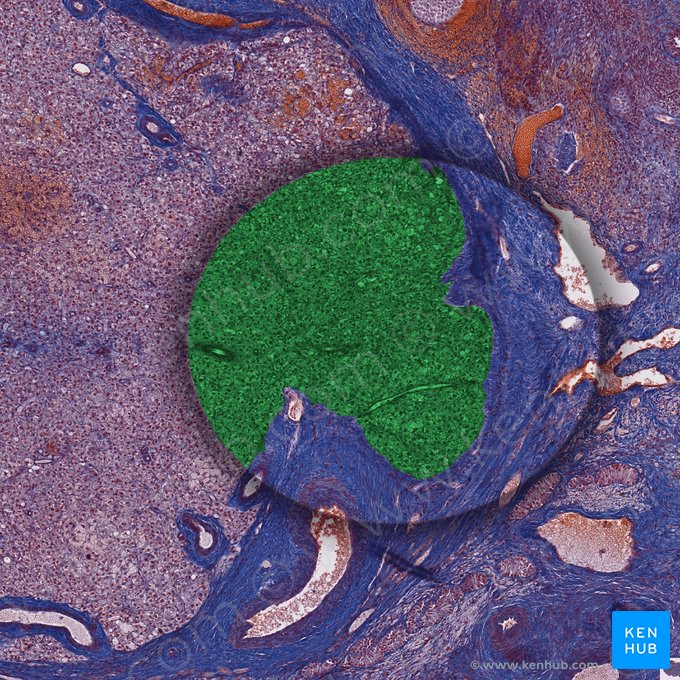 Granulosa lutein cells; Image: 