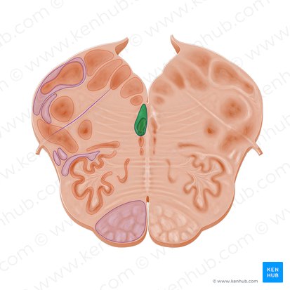 Medial longitudinal fasciculus (Fasciculus longitudinalis medialis); Image: Paul Kim