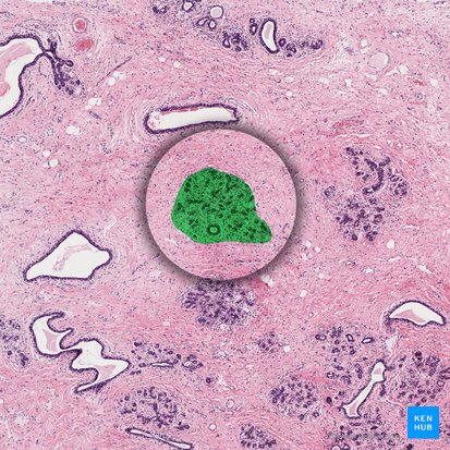 Unidad lobular ductal terminal (Lobulus mammae); Imagen: 