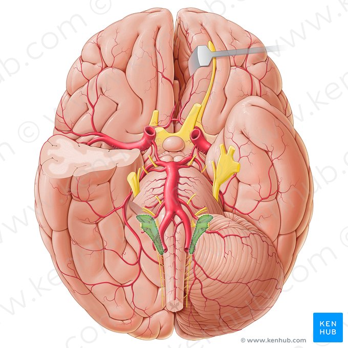 Cisterna cerebelobulbar lateral (Cisterna cerebellomedullaris lateralis); Imagen: Paul Kim