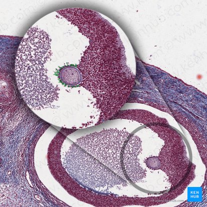 Corona radiata: Anatomy and location | Kenhub