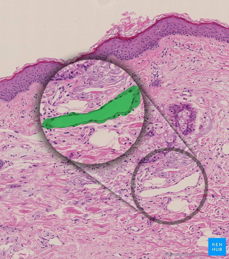 Lymphatic vessel of dermis - histological slide