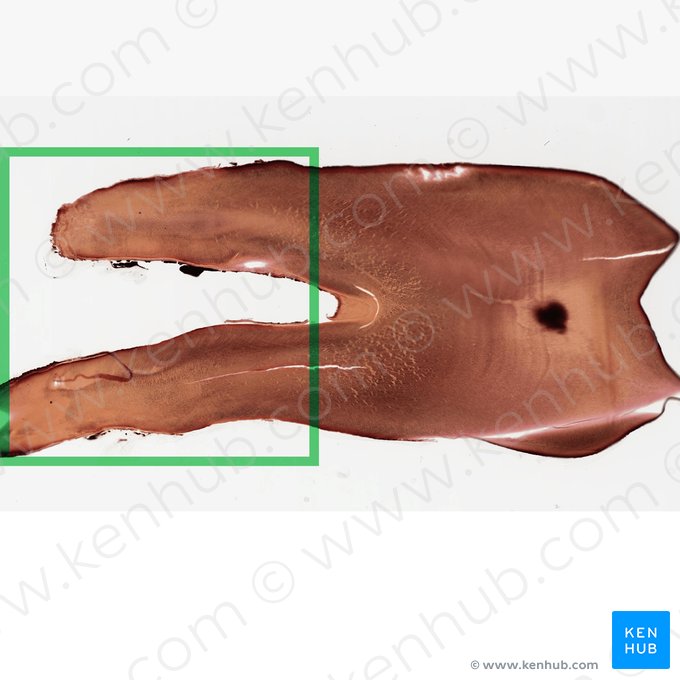 Raiz do dente (Radix dentis); Imagem: 