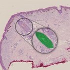 Histology of the skin appendages