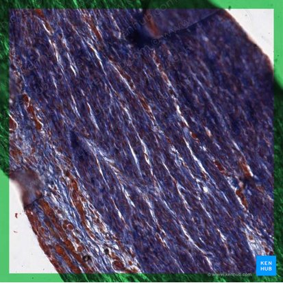 Dense regular collagenous connective tissue; Image: 