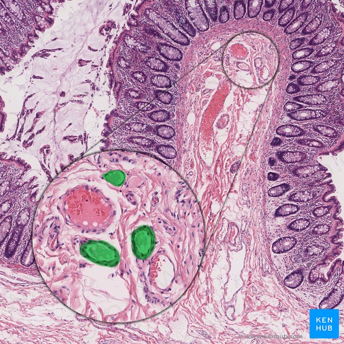 Vaso linfático (Vas lymphaticum); Imagen: 