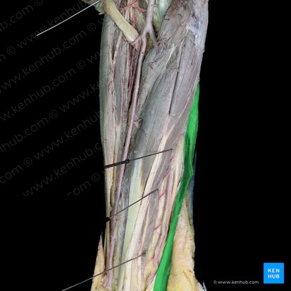 Musculus flexor carpi ulnaris (Ellenseitiger Handbeuger); Bild: 