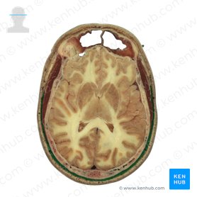 Mimische Muskulatur Anatomie, Funktion, Fazialisparese Kenhub