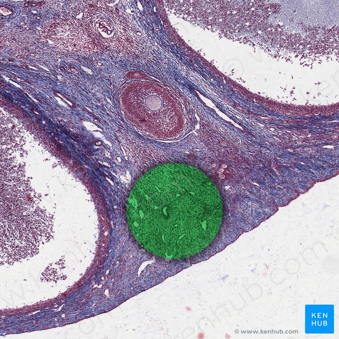 Ovarian stroma; Image: 