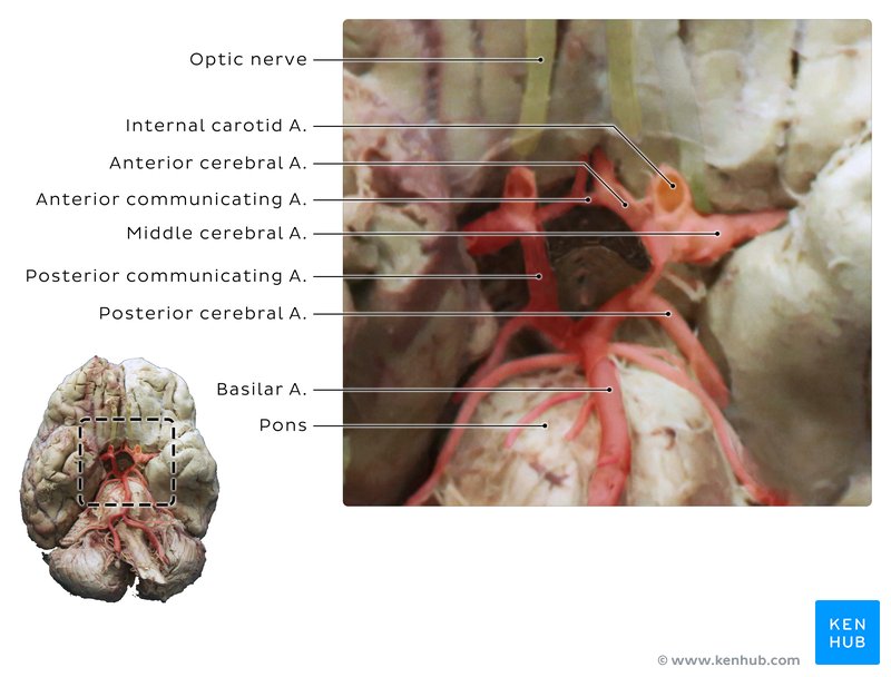 Circle of Willis - cadaveric image