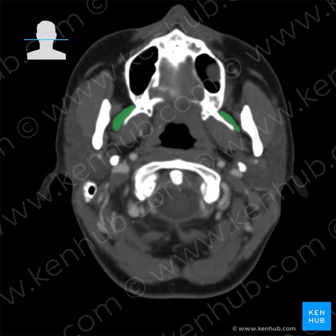 Musculus pterygoideus lateralis (Äußerer Flügelmuskel); Bild: 