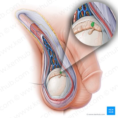 Appendix epididymidis (Nebenhodenanhängsel); Bild: Paul Kim