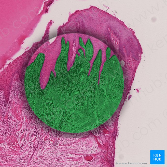 Fasern der Gingiva; Bild: 