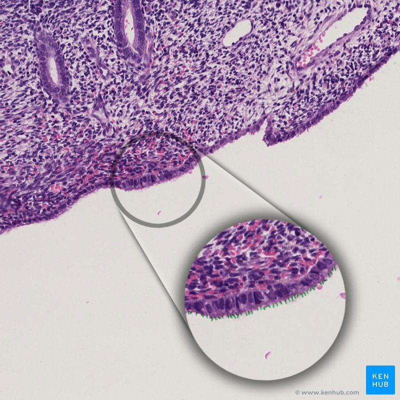 Lâmina histológica - corada com H&E (hematoxilina e eosina) onde se pode observar quinocílios