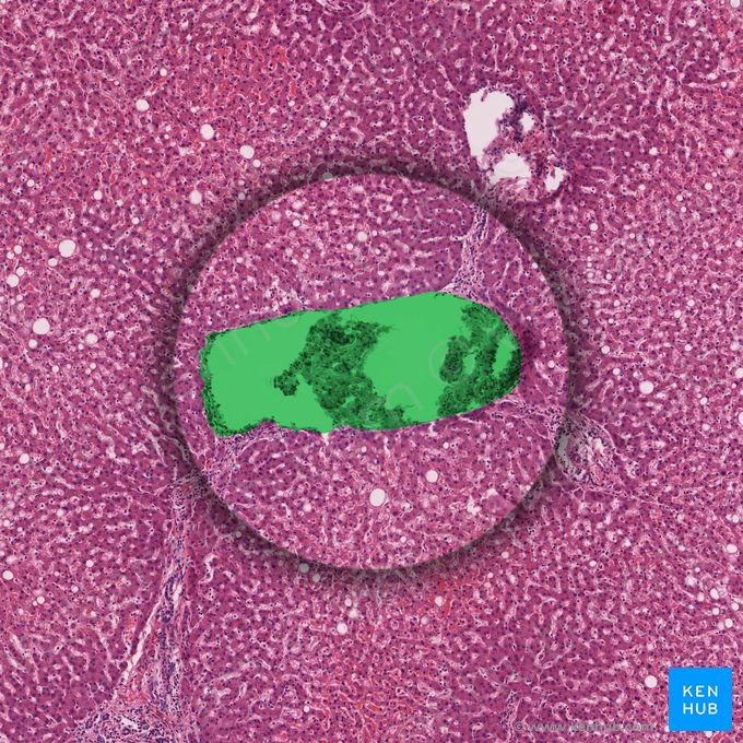 Sublobular vein (Vena sublobularis); Image: 