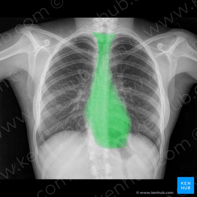 Mediastino (Mediastinum); Imagem: 