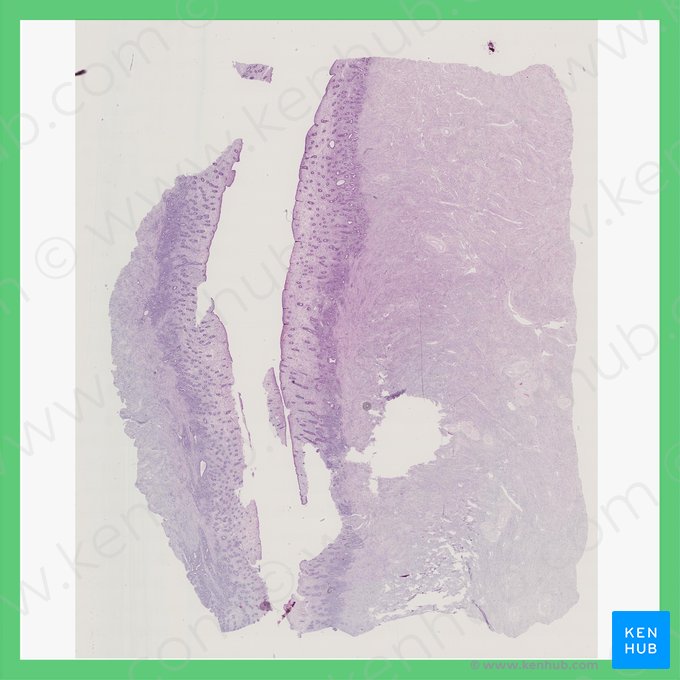 Phase médiane de la phase proliférative (Phasis proliferativa intermedia (Uterus)); Image : 