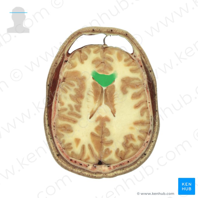 Genu of corpus callosum (Genu corporis callosi); Image: National Library of Medicine