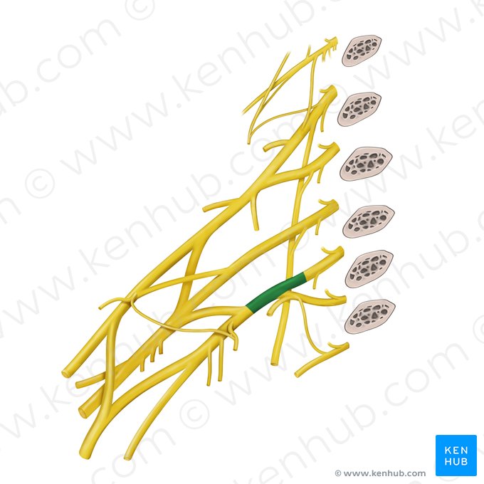 Inferior trunk of brachial plexus (Truncus inferior plexus brachialis); Image: Begoña Rodriguez