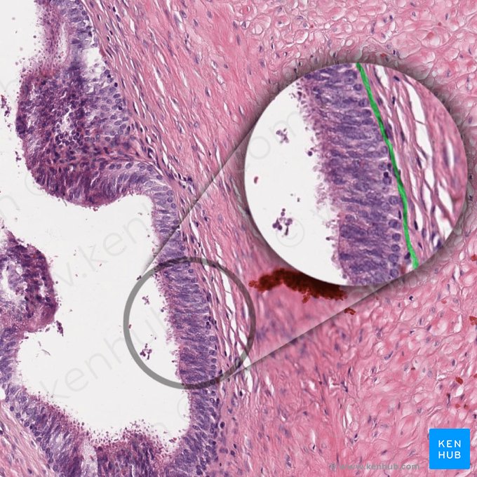 Basement membrane (Membrana basalis); Image: 