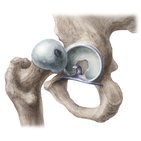 Hip joint