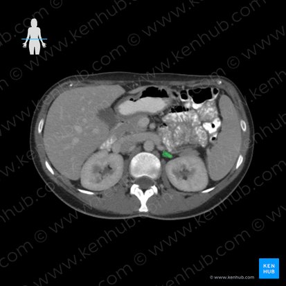 Suprarenal gland (Glandula suprarenalis); Image: 