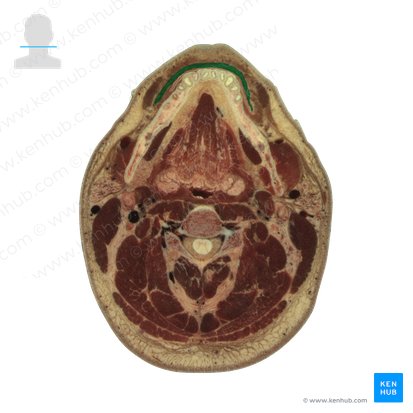 Orbicularis oris muscle (Musculus orbicularis oris); Image: National Library of Medicine