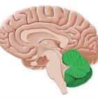 Cerebellar degeneration