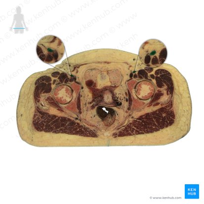 Arteria iliaca externa (Äußere Beckenarterie); Bild: National Library of Medicine