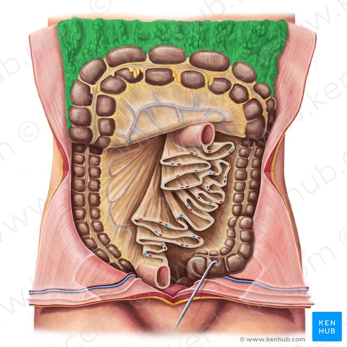 Omentum majus (Großes Netz); Bild: Irina Münstermann