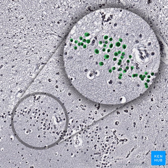 Células granulares; Imagen: 