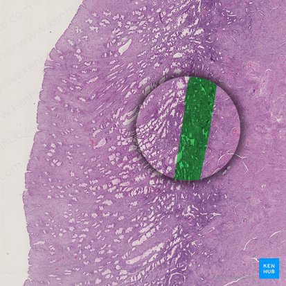 Basalschicht des Endometriums; Bild: 
