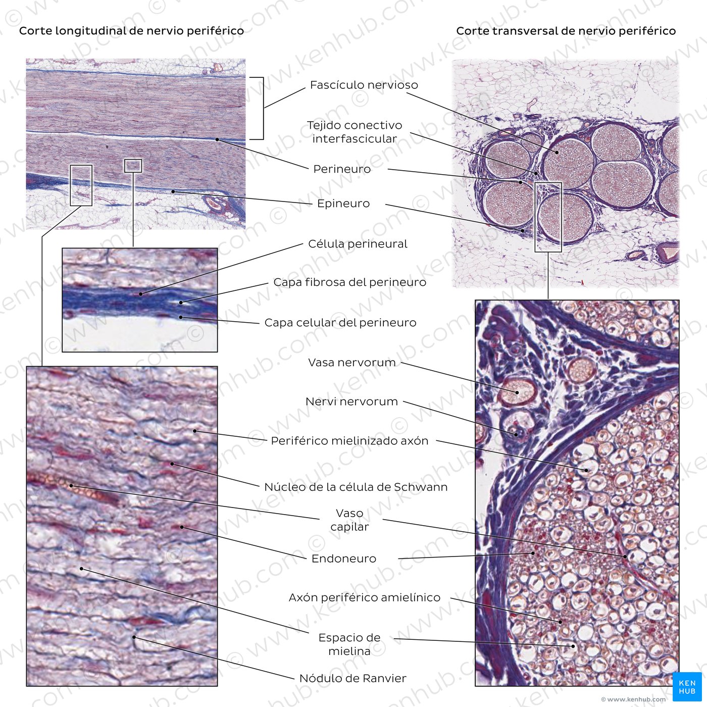 Histología del nervio periférico