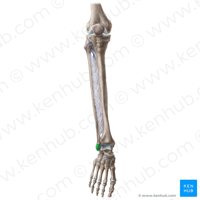 Maléolo lateral da fíbula (Malleolus lateralis fibulae); Imagem: Liene Znotina