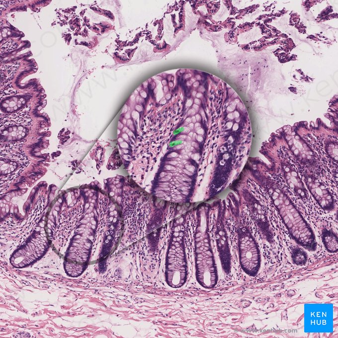 Célula enteroendócrina (Endocrinocytus gastrointestinalis); Imagen: 