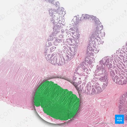 Capa muscular (Tunica muscularis); Imagen: 