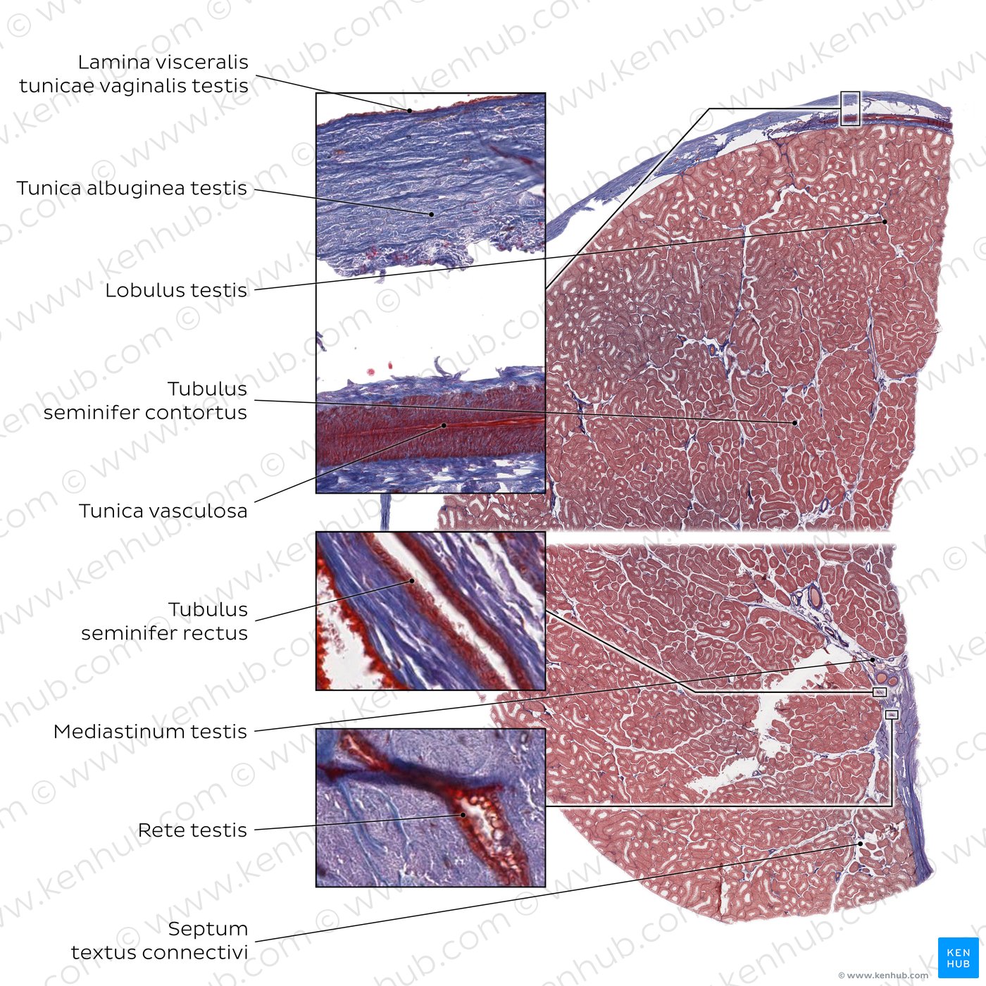 Hoden (histologisches Präparat: geringe Vergrößerung, Färbung: Ladewig)