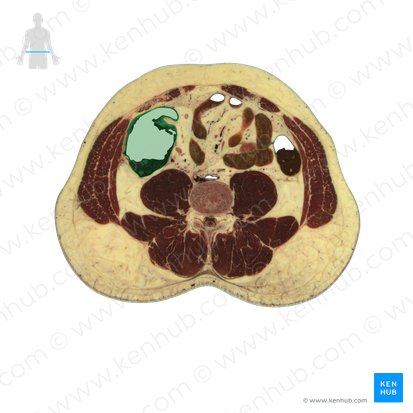 Ascending colon (Colon ascendens); Image: National Library of Medicine