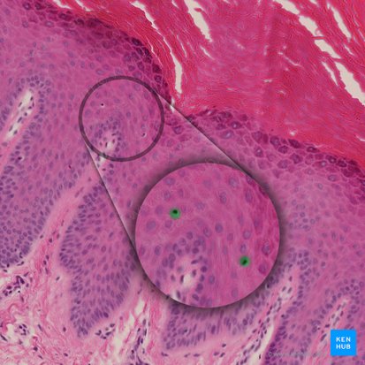 Langerhans cell (Cellula Langerhans); Image: 