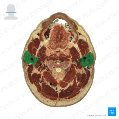 Parotid gland (Glandula parotidea); Image: National Library of Medicine