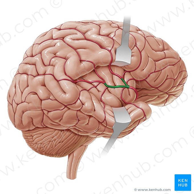 Partes corticales superiores et inferiores arteriae cerebri mediae (Obere und untere Endäste der mittleren Hirnarterie); Bild: Paul Kim