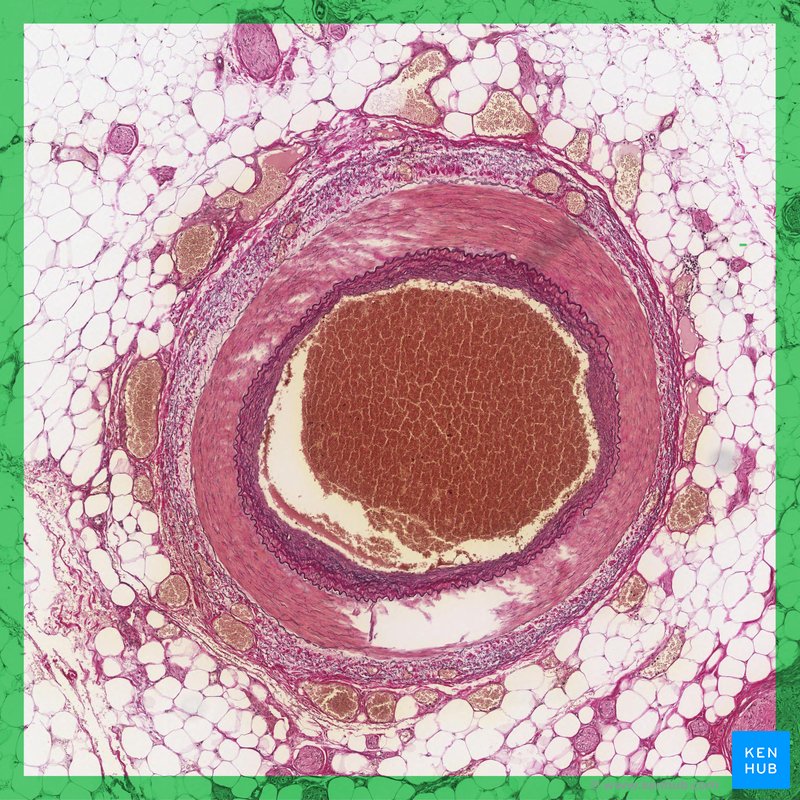 Muscular artery - histological slide