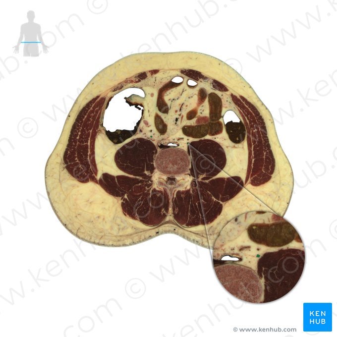 Ureter; Image: National Library of Medicine